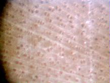 Aspen:  Treated with BioVam