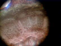 Roses Treated with BioVam