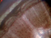Roses Untreated