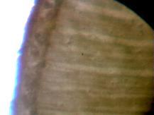 Untreated has smaller Pholem and much fewer Xylem.